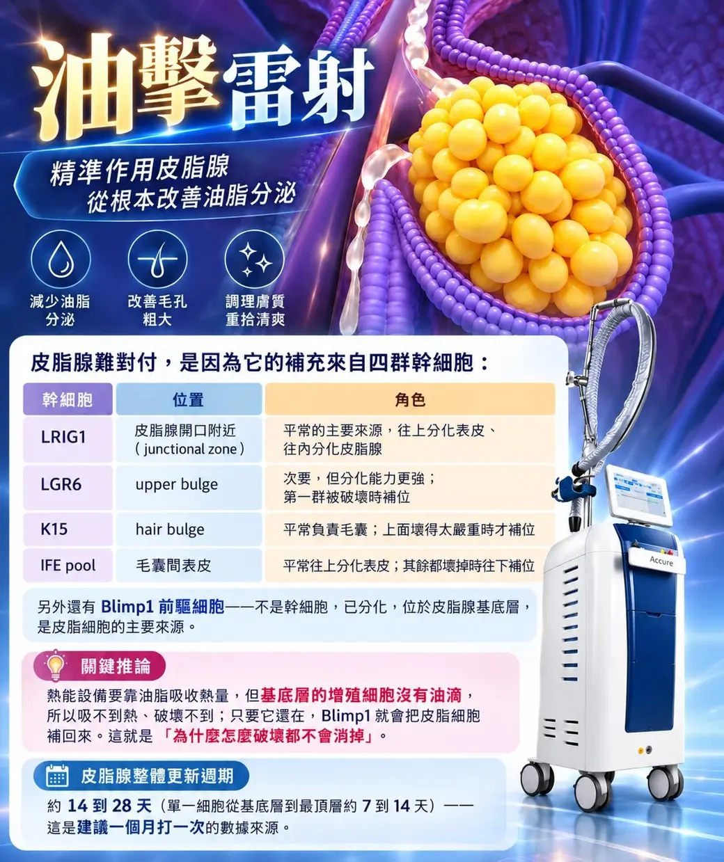 作者提供的圖卡。上半是「油擊雷射」大字標題與「精準作用皮脂腺，從根本改善油脂分泌」副標，右側是皮脂腺的立體示意圖（黃色油滴群被紫色細胞包覆）與儀器主機照片；下半是一張四群幹細胞的表格，列出 LRIG1、LGR6、K15、IFE pool 的位置與角色，以及 Blimp1 前驅細胞、「基底層的增殖細胞沒有油滴」的關鍵推論，和皮脂腺整體更新週期 14 到 28 天。