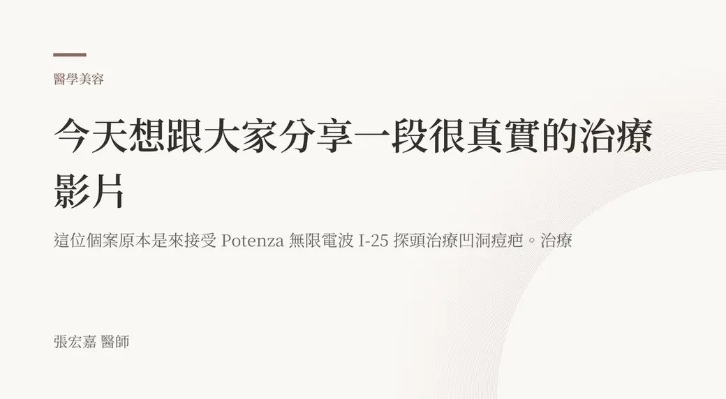 排版式文字封面，米白底，左上角有褐色短線與「醫學美容」標示，副標寫著這位個案原本是來接受無限電波探頭治療凹洞痘疤，左下角署名張宏嘉醫師。