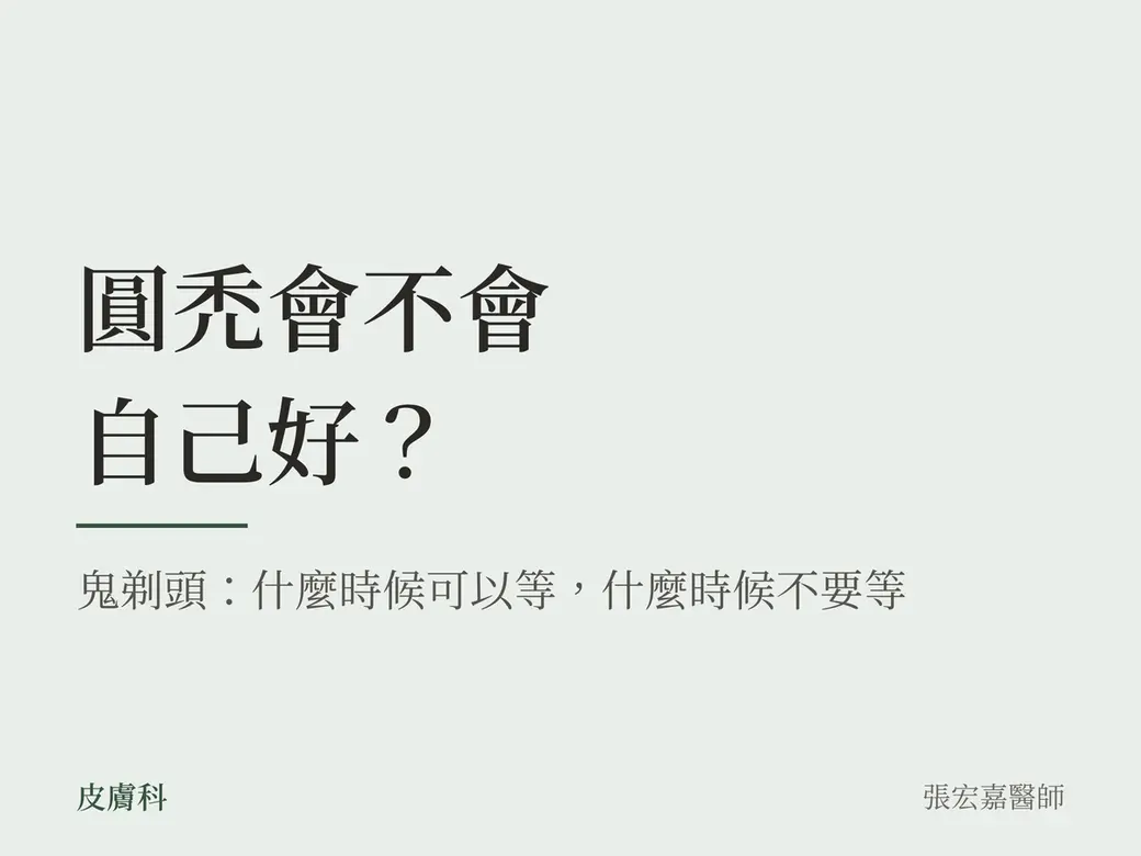 純文字的問題卡封面，淡綠底。大字主標「圓禿會不會自己好？」，下面一道綠色短線與副標「鬼剃頭：什麼時候可以等，什麼時候不要等」，左下「皮膚科」，右下署名張宏嘉醫師。沒有照片、圖示、產品或數字。