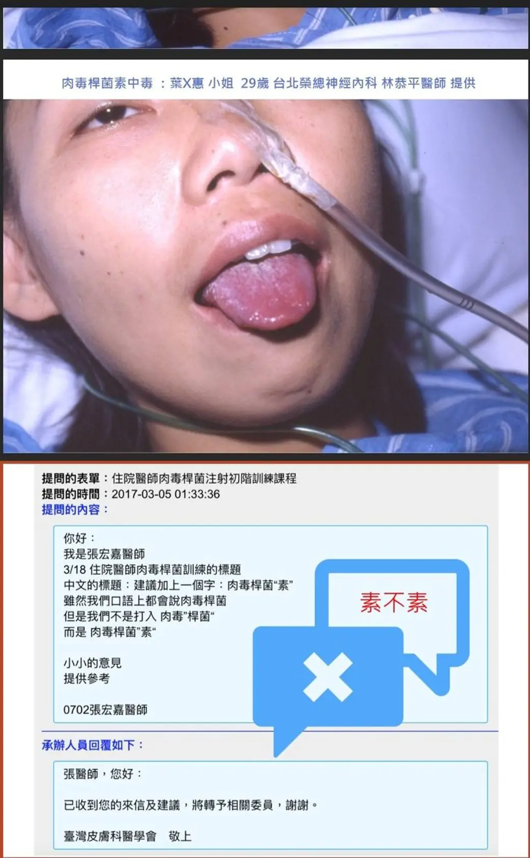 翻拍畫面，上半是一張病例照片，一位女性躺著張口、鼻腔插著管路，上方標題寫著肉毒桿菌素中毒的病例資訊；下半是一則向醫學會提出的建議信與回覆的網頁截圖。