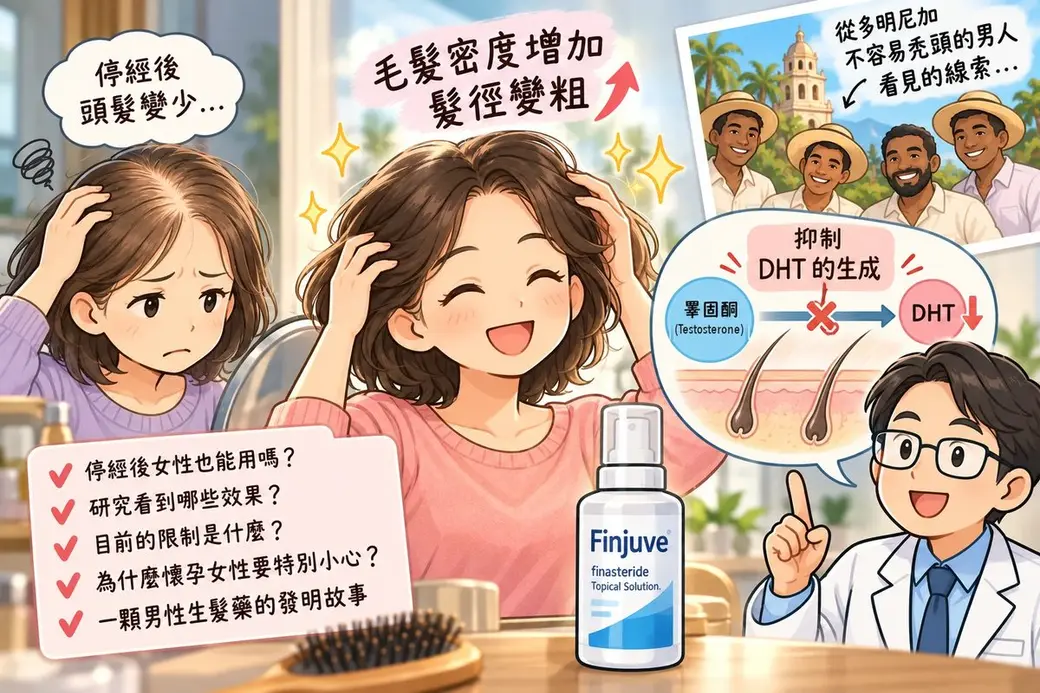手繪漫畫風插圖。左邊一位停經後女性皺眉摸著頭頂稀疏的頭髮，想著「停經後頭髮變少…」；中間同一位女性開心地摸著頭髮，上方寫「毛髮密度增加、髮徑變粗」，桌上放著一瓶 Finjuve（finasteride）噴劑；右上角一張照片寫「從多明尼加不容易禿頭的男人看見的線索…」；右下角一位戴眼鏡的醫師旁邊的示意圖，標示睪固酮轉成 DHT 的路徑被打叉、「抑制 DHT 的生成」；左下角清單列出：停經後女性也能用嗎、研究看到哪些效果、目前的限制是什麼、為什麼懷孕女性要特別小心、一顆男性生髮藥的發明故事。