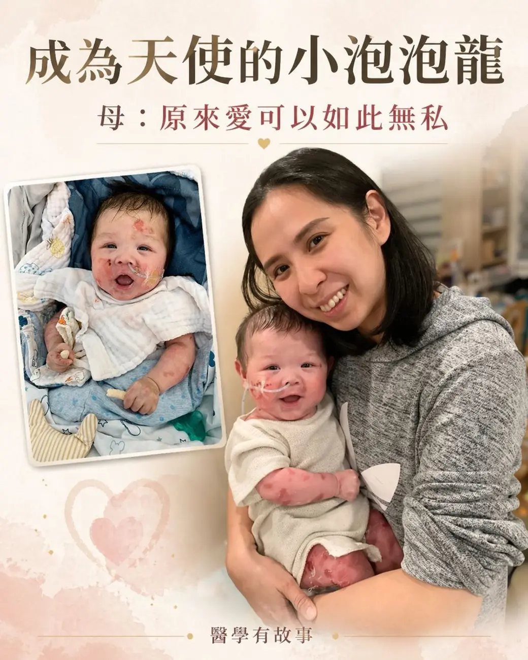 家庭照片，一位女性抱著一名身上有大片破皮與傷口的嬰兒微笑，左上角另有一張同一名嬰兒的照片，上方寫著「成為天使的小泡泡龍」。