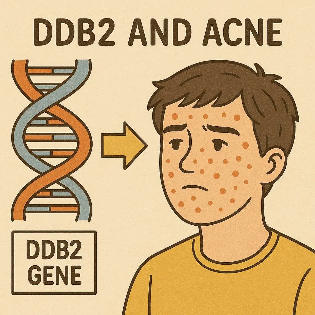 插畫圖卡，米色底，左邊是一段 DNA 雙股螺旋，箭頭指向右邊一位滿臉痘痘的男孩，上方寫著 DDB2 AND ACNE，左下角標著 DDB2 GENE。