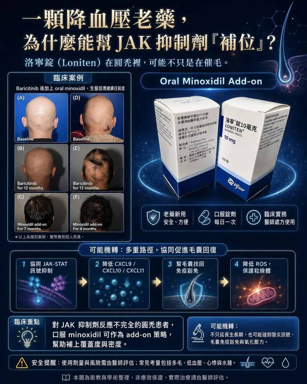 自製衛教圖卡，深藍底，左半是四格圓禿病人治療前後的頭部照片與時間標註，右半是藥盒照片與四步驟的可能機轉流程，最下方有安全提醒與「本圖為衛教與學術整理，非療效保證」的註記。