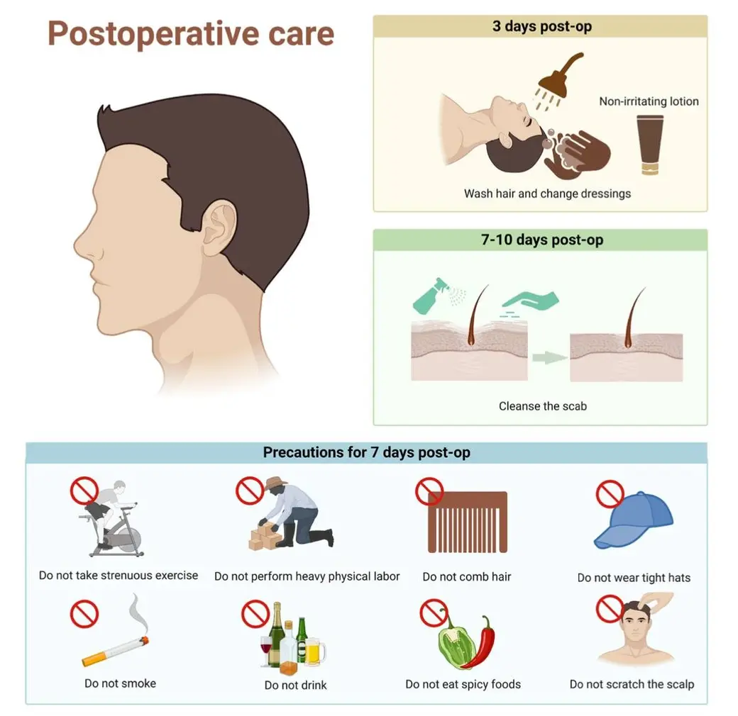 衛教圖卡，標題 Postoperative care，左側是側臉線稿，右側兩格分別說明術後三天與七到十天的清潔方式，下方八個禁止圖示列出七天內不要劇烈運動、搬重物、梳頭、戴緊帽子、抽菸、喝酒、吃辣與抓頭皮。