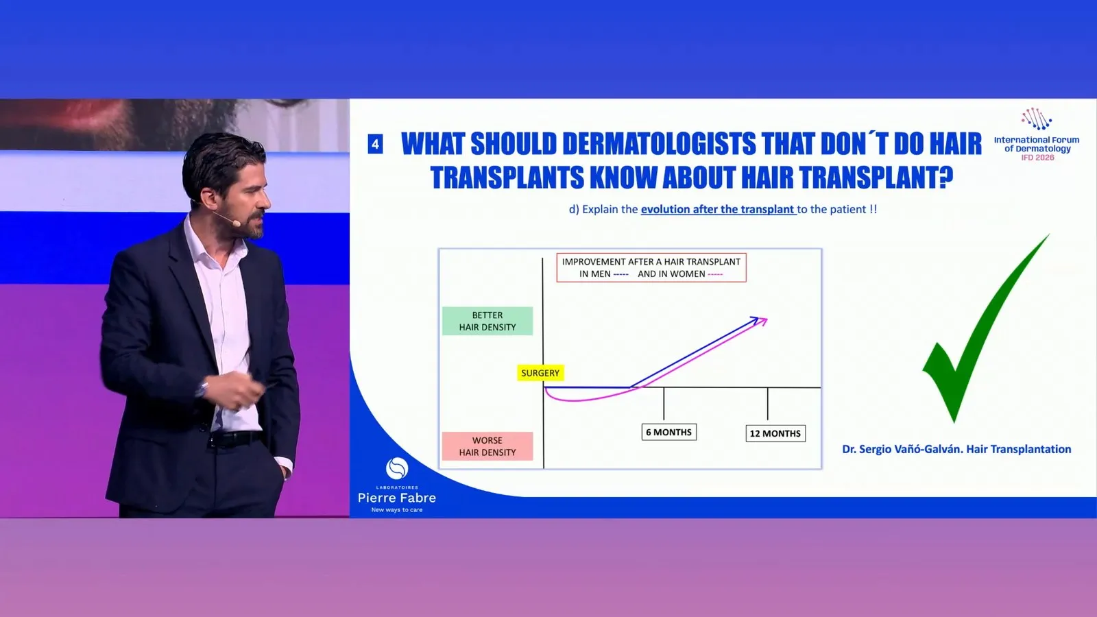 Vañó-Galván 醫師投影片「What should dermatologists that don't do hair transplants know about hair transplant?」第 4 點「向病人解釋植髮後的變化」:一張示意曲線,橫軸是時間,手術後髮量先往下掉,6 個月左右回到原點,12 個月往上升,男性與女性各一條線。