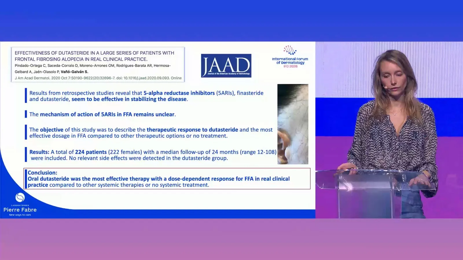Mathieu 醫師投影片:Pindado-Ortega 等 2021 年 JAAD 論文〈Effectiveness of dutasteride in a large series of patients with frontal fibrosing alopecia in real clinical practice〉的重點:回溯研究顯示 5α 還原酶抑制劑似乎能穩定病情、機轉仍不清楚;224 位病人(222 位女性),中位追蹤 24 個月;結論是口服 dutasteride 在真實世界最有效,而且效果與劑量相關。