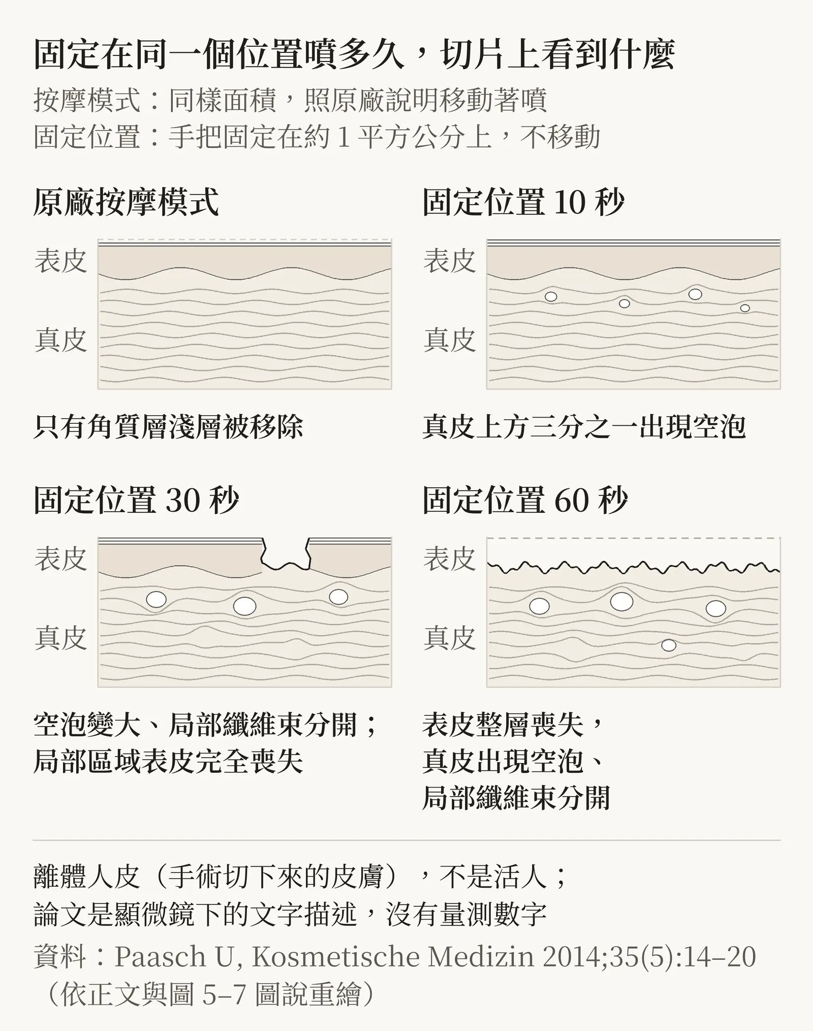 原廠按摩模式,以及手把固定位置噴射 10、30、60 秒的組織變化示意圖