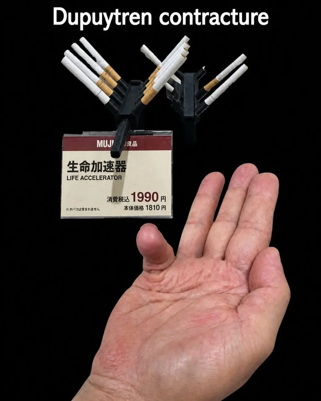合成圖卡，黑底上一隻攤開的手掌，小指側的掌面有一塊隆起的硬塊，上方是交叉排列的香菸與一張寫著「生命加速器 LIFE ACCELERATOR」的價格標籤，最上方印著 Dupuytren contracture。