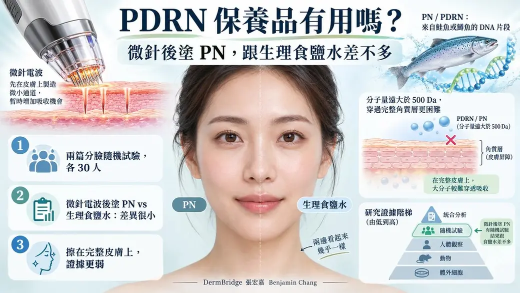 AI 生成的示意海報。標題「PDRN 保養品有用嗎？微針後塗 PN，跟生理食鹽水差不多」；中間是一張分成兩半的女性臉，左半標 PN、右半標生理食鹽水，兩邊看起來幾乎一樣；左邊是微針電波在皮膚上打出通道的示意圖與三個重點；右邊是鮭魚與 DNA、大分子被角質層擋住的示意圖，以及從體外細胞到統合分析的證據階梯。