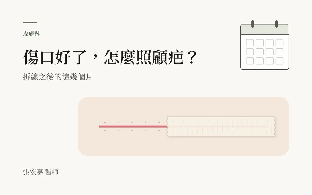 排版式封面，淺色底，左上「皮膚科」與主標「傷口好了，怎麼照顧疤？」，副標「拆線之後的這幾個月」。右上一頁沒有寫數字的月曆；下方一小片淡膚色的皮膚上有一條細細的粉紅色線，線的兩側留著淡淡的針孔，右半段順著線貼了一條米白色、兩端撕成鋸齒的紙膠帶。左下角署名張宏嘉醫師。全部是自繪示意圖，沒有人臉、產品或療效數字。