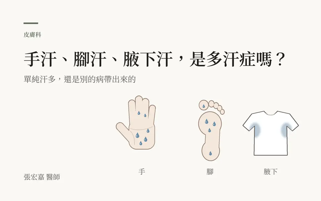排版式封面，淺色底，左上「皮膚科」與主標「手汗、腳汗、腋下汗，是多汗症嗎？」，副標「單純汗多，還是別的病帶出來的」。右下三個線稿：一隻張開的手掌、一個腳底，上面都有藍色的汗滴；一件白色短袖上衣，兩邊腋下各有一圈淡藍色的汗漬。三個圖下面分別標「手」「腳」「腋下」。左下角署名張宏嘉醫師。全部是自繪示意圖，沒有人臉、產品或數字。