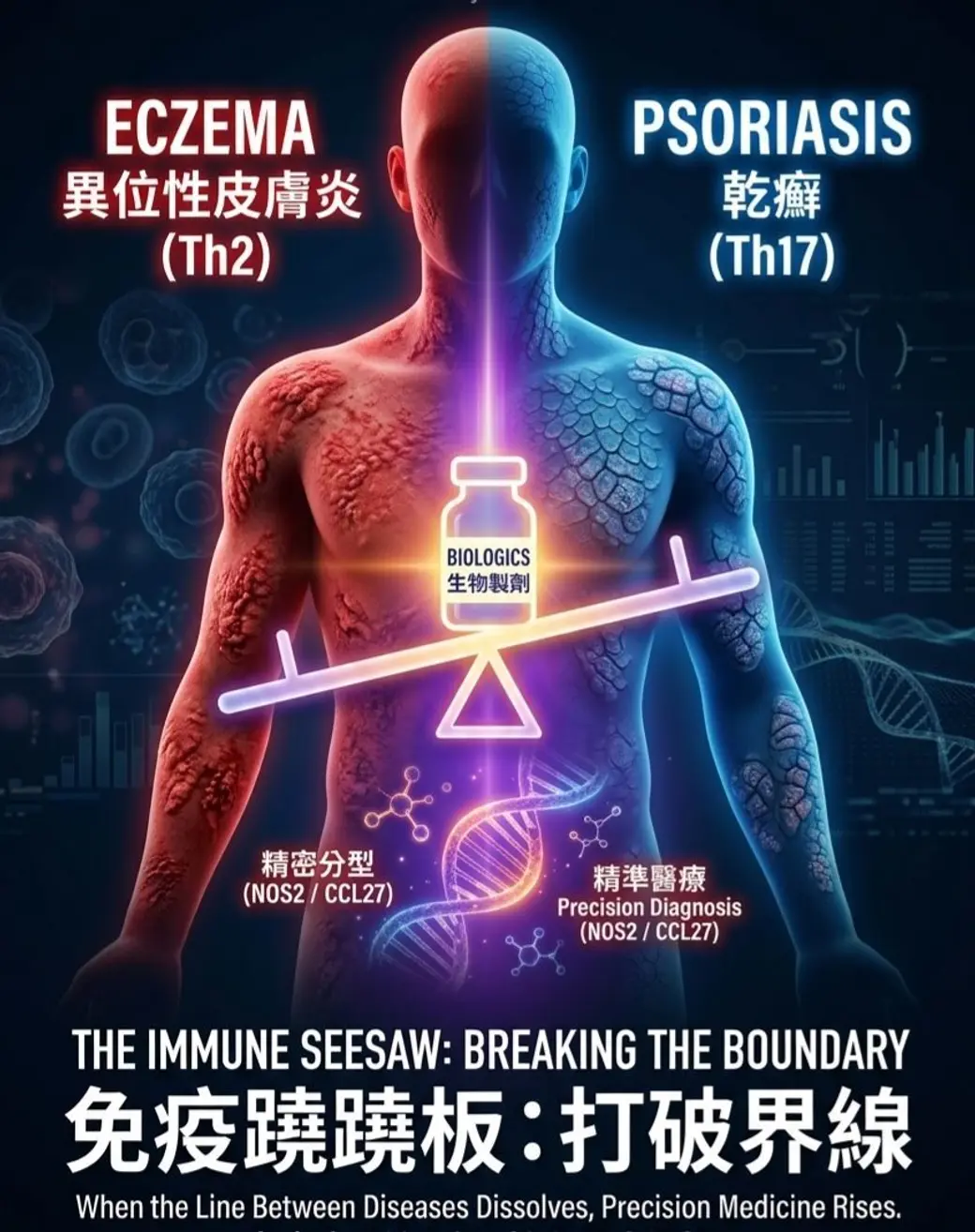 合成海報，中央一具人體左右各半，左半紅色標示異位性皮膚炎與 Th2，右半藍色標示乾癬與 Th17，中間是一個以生物製劑瓶為支點的蹺蹺板，下方寫著 THE IMMUNE SEESAW: BREAKING THE BOUNDARY。