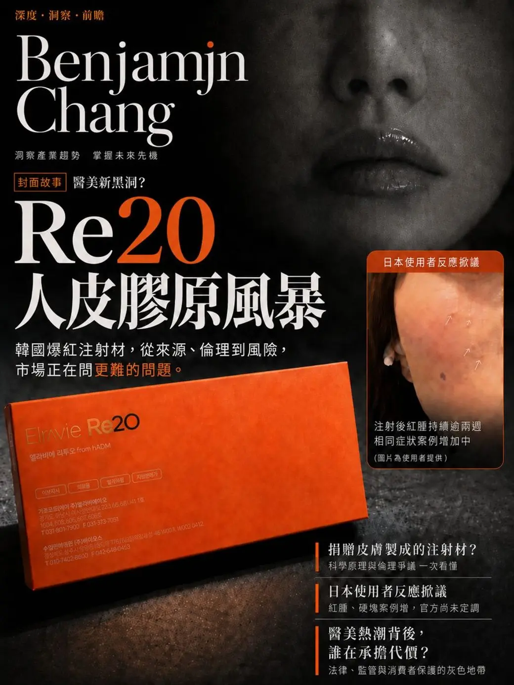 仿雜誌封面的合成圖，黑白背景是一張臉的下半部，左上是刊名與封面故事標題，中央是一盒橘色包裝的注射材，右側有一張紅腫皮膚的小圖與日文使用者反應的說明，下方條列三個爭議問題。