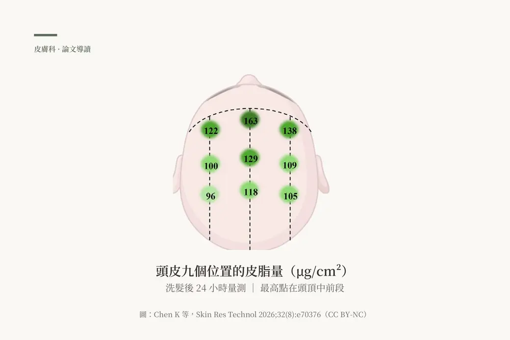 從頭頂俯視的頭皮示意圖，九個位置標上皮脂量數值，頭頂中前段的 163 最高，往兩側與後方遞減至 96
