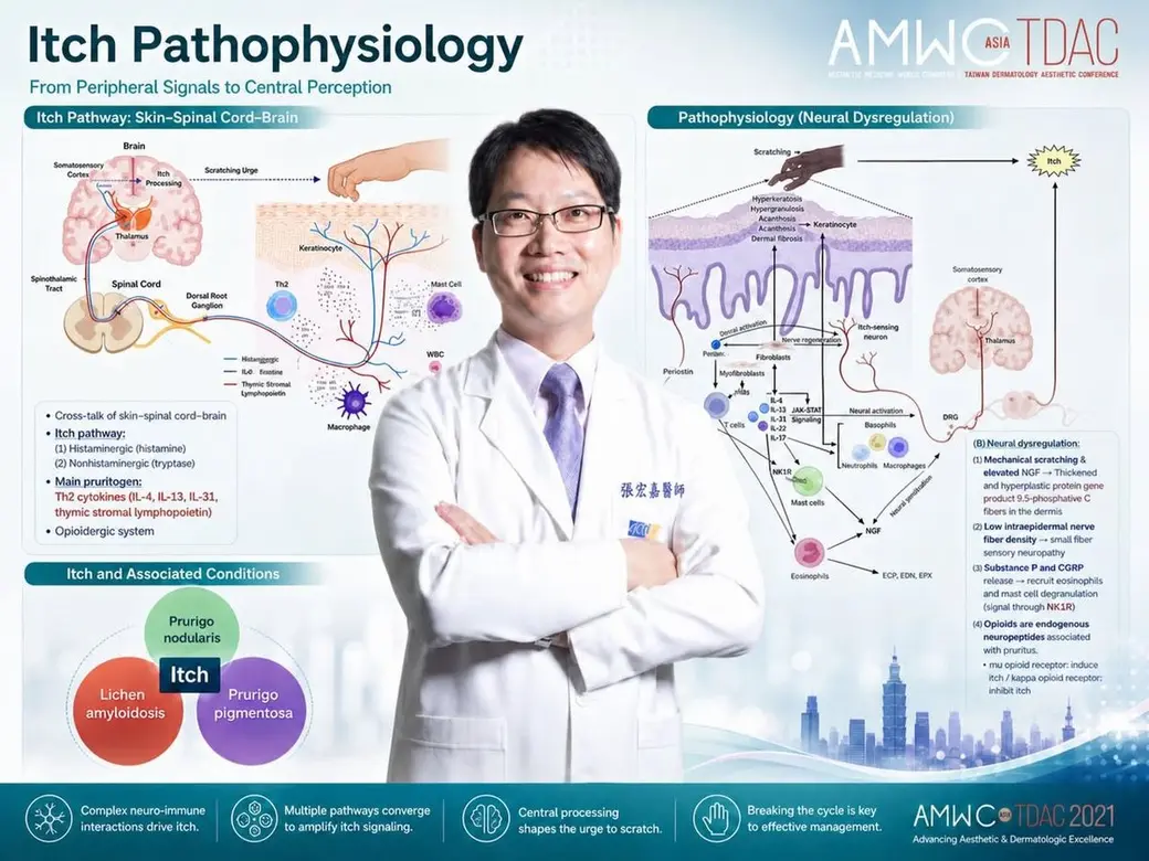 學術海報，標題 Itch Pathophysiology，左半是從皮膚經脊髓到腦的癢覺傳導示意圖，右半是神經失調的機制圖，中間是一位抱胸微笑的白袍醫師，下方是四項重點與會議標誌。