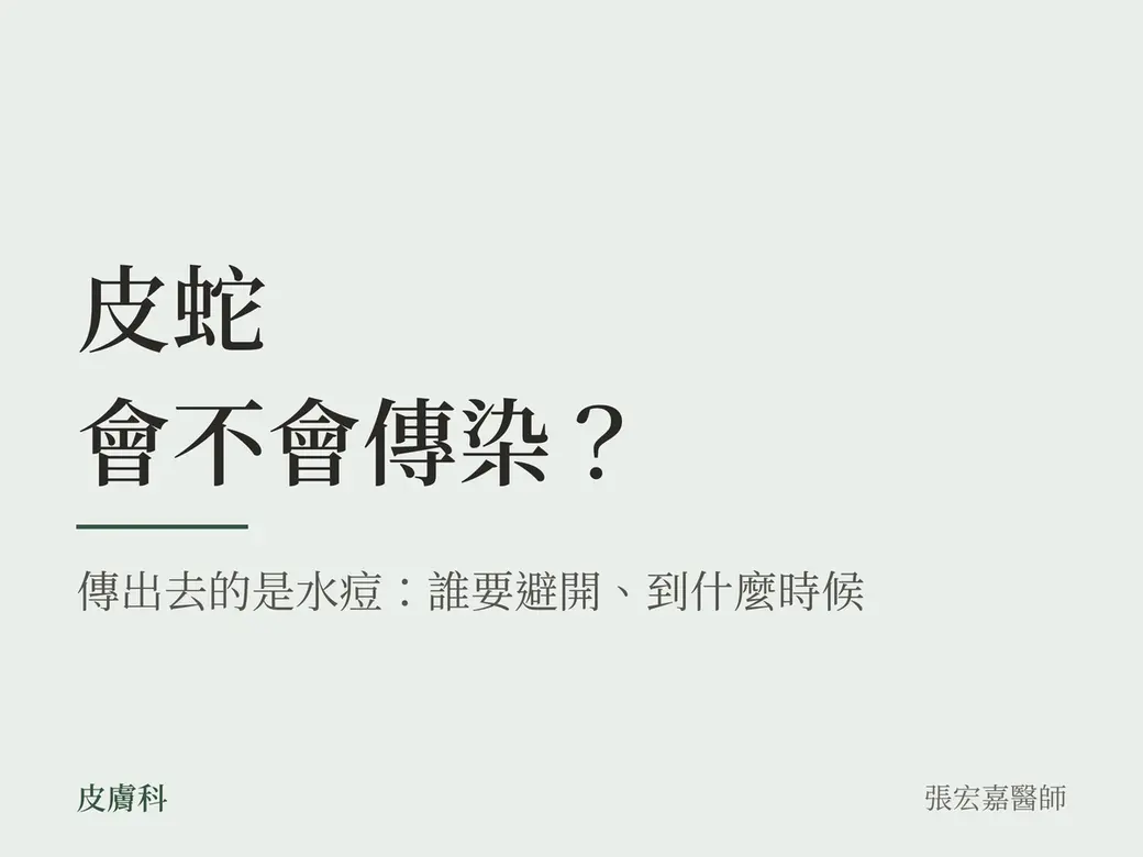 問題卡封面，淺綠色底，只有文字。主標「皮蛇會不會傳染？」，副標「傳出去的是水痘：誰要避開、到什麼時候」。左下角是「皮膚科」，右下角署名張宏嘉醫師。沒有照片、產品包裝或數字。