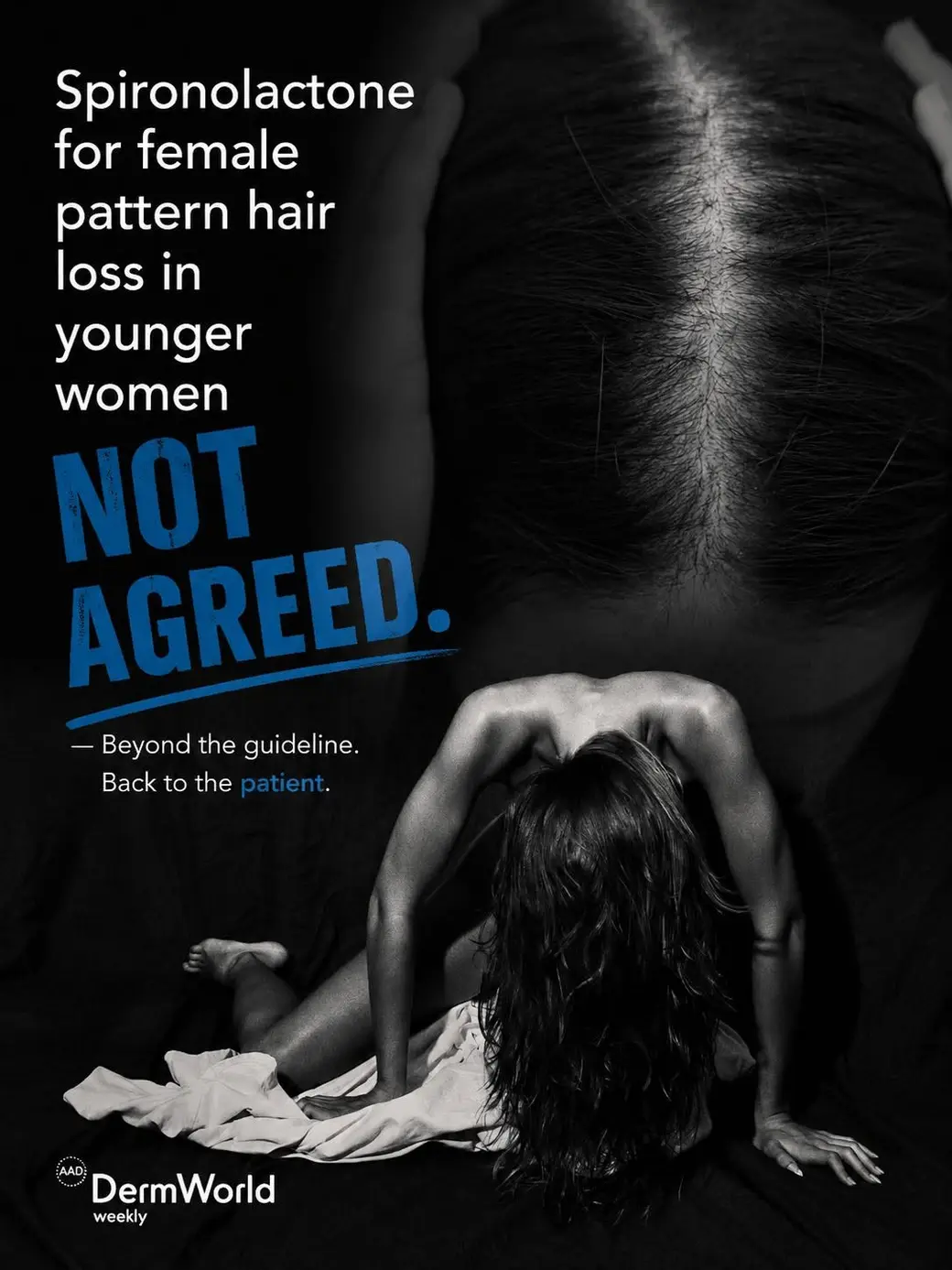 Spironolactone for female pattern hair loss in younger women — NOT AGREED.