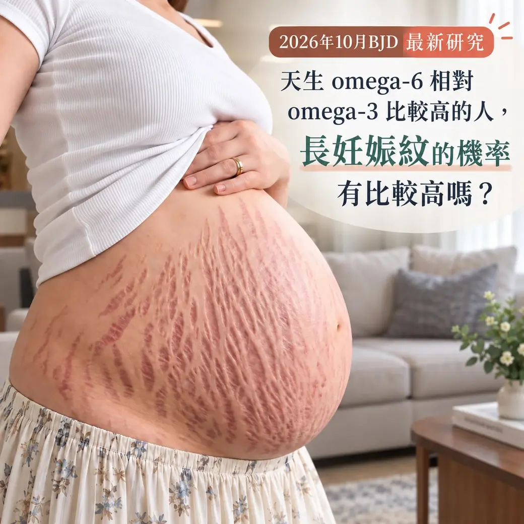 作者以 AI 生成的示意照片，一位孕婦站在客廳裡掀起白色上衣，露出隆起的腹部，皮膚上有大片放射狀的紅紫色妊娠紋，右上角疊加中文提問「天生 omega-6 相對 omega-3 比較高的人，長妊娠紋的機率有比較高嗎？」。