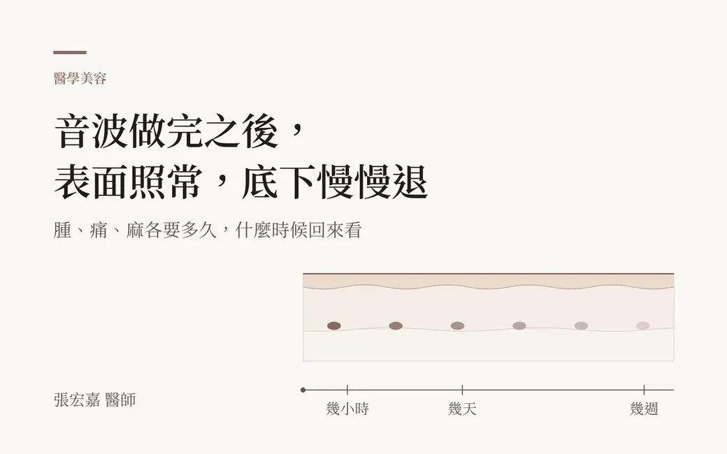 排版式文字封面，淺色底，主標「音波做完之後，表面照常，底下慢慢退」。畫面下半是一個皮膚小剖面：表面一條完整的細線，底下幾毫米處排著一列小小的點，顏色由深到淺；剖面下方一條橫向的時間軸，只標「幾小時、幾天、幾週」三個刻度。副標「腫、痛、麻各要多久，什麼時候回來看」。左下角署名張宏嘉醫師。畫面沒有人臉、儀器、產品或品牌標記，也沒有療效數字。
