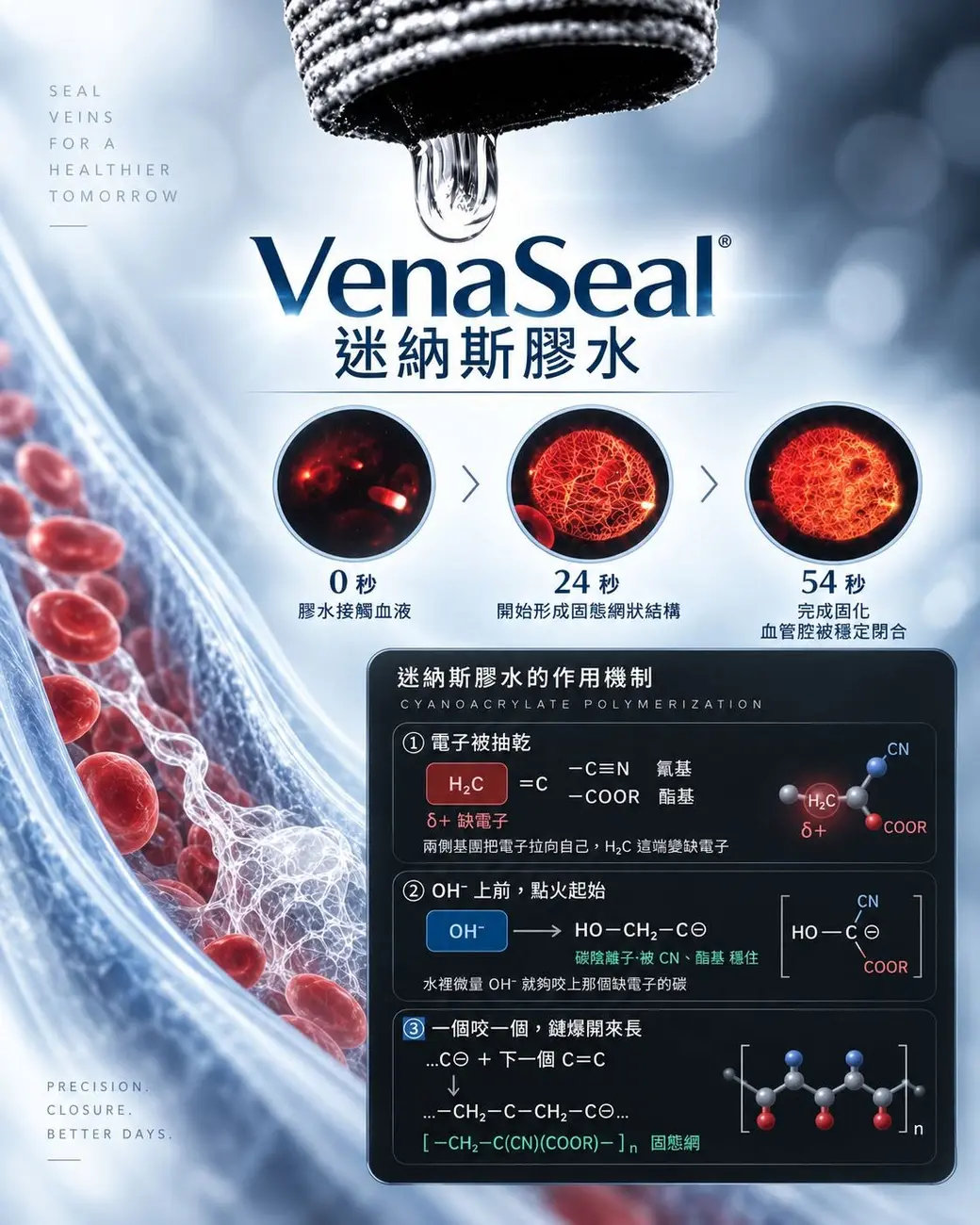 VenaSeal 迷納斯膠水的作用機制：0 秒膠水接觸血液、24 秒形成固態網狀結構、54 秒完成固化。
