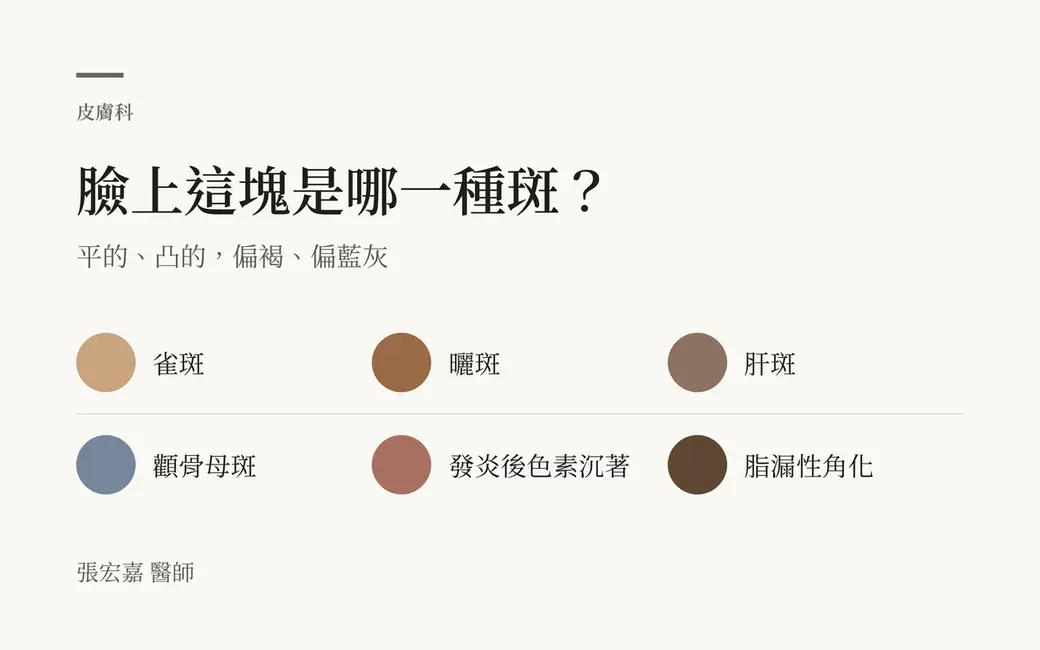 排版式文字封面，暖白底，主標「臉上這塊是哪一種斑？」，副標「平的、凸的，偏褐、偏藍灰」。下方兩列共六個小圓形色票，有淺褐、中褐、灰褐、藍灰、紅褐、深褐，各自標著雀斑、曬斑、肝斑、顴骨母斑、發炎後色素沉著、脂漏性角化。畫面沒有人臉、病灶照片、產品或數字。