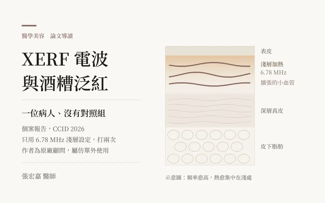 排版式數據封面，淺色底，主標寫著 XERF 電波與酒糟泛紅，副標寫著一位病人、沒有對照組，左下角署名張宏嘉醫師；右側是一張皮膚分層示意圖，標出淺層加熱與擴張的小血管位置。畫面上沒有人臉、儀器照片、產品包裝或放大的療效數字。
